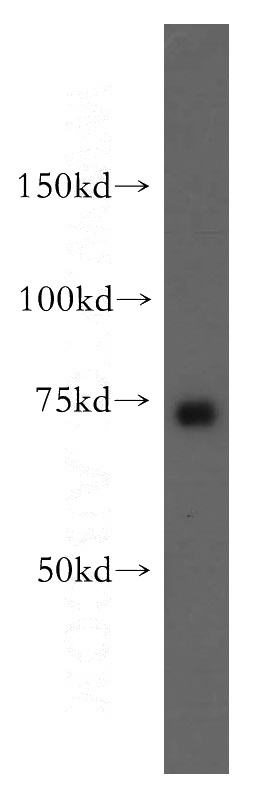 human liver tissue were subjected to SDS PAGE followed by western blot with Catalog No:112791(MTO1 antibody) at dilution of 1:500