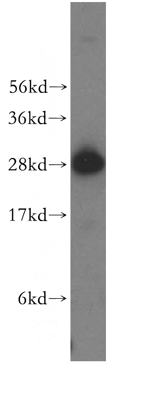 Raji cells were subjected to SDS PAGE followed by western blot with Catalog No:108420(BCAP29 antibody) at dilution of 1:1000