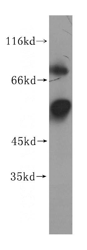 mouse testis tissue were subjected to SDS PAGE followed by western blot with Catalog No:114154(PPP5C antibody) at dilution of 1:500