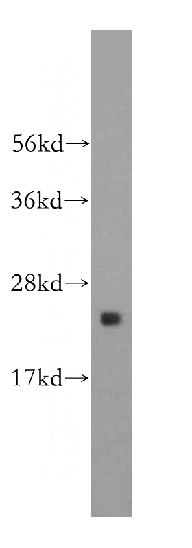 human brain tissue were subjected to SDS PAGE followed by western blot with Catalog No:114903(RPL9 antibody) at dilution of 1:800