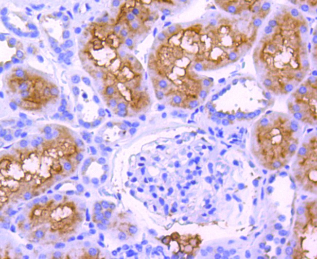 Fig8: Immunohistochemical analysis of paraffin-embedded human kidney tissue using anti-ABCF1 antibody. Counter stained with hematoxylin.