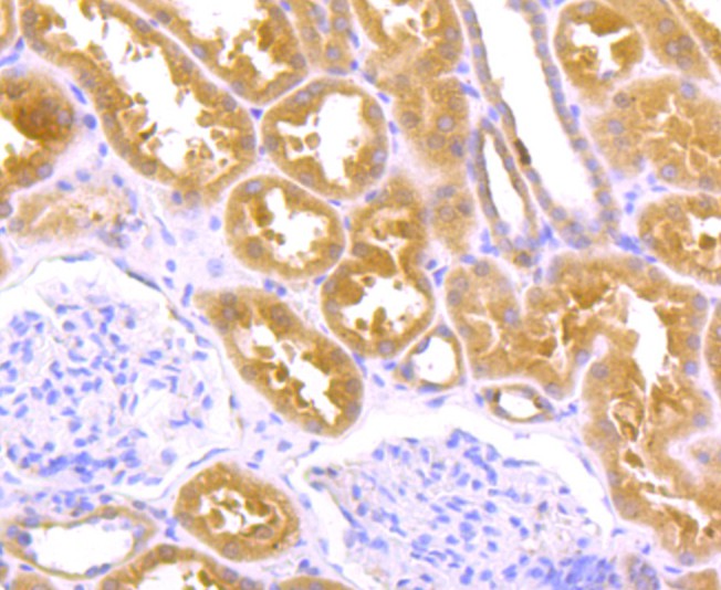 Fig5: Immunohistochemical analysis of paraffin-embedded human kidney tissue using anti-TGM6 antibody. Counter stained with hematoxylin.