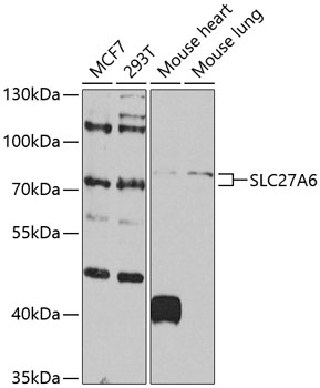 Western blot - SLC27A6 Polyclonal Antibody 