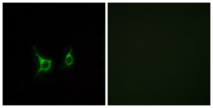 Fig1:; Immunofluorescence analysis of COS7 cells, using FFAR2 Antibody. The picture on the right is blocked with the synthesized peptide.