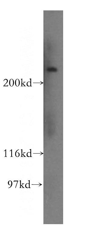 HepG2 cells were subjected to SDS PAGE followed by western blot with Catalog No:113887(FAM38A antibody) at dilution of 1:400