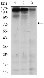 Western blot analysis using MSH6 mouse mAb against MCF-7 (1), HEK293 (2), and HCT116 (3) cell lysate.