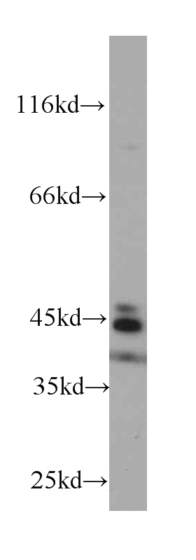 Raji cells were subjected to SDS PAGE followed by western blot with Catalog No:107125(CD23,FCER2 antibody) at dilution of 1:1000