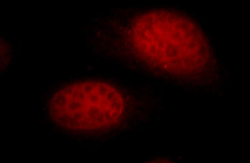 Immunofluorescent analysis of HepG2 cells, using UHRF1 antibody Catalog No:116563 at 1:25 dilution and Rhodamine-labeled goat anti-rabbit IgG (red).