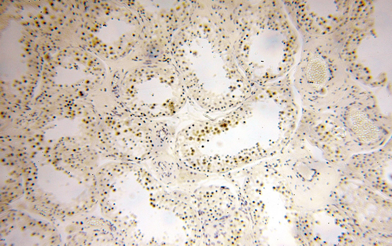 Immunohistochemical of paraffin-embedded human testis using Catalog No:108535(BTBD1 antibody) at dilution of 1:100 (under 10x lens)