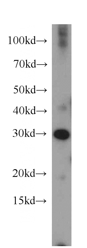 human skeletal muscle tissue were subjected to SDS PAGE followed by western blot with Catalog No:112863(MRTO4 antibody) at dilution of 1:500