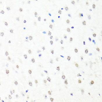 Immunohistochemistry - CHRAC1 Polyclonal Antibody 