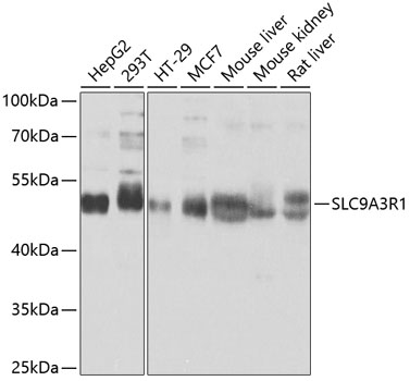 Western blot - SLC9A3R1 Polyclonal Antibody 