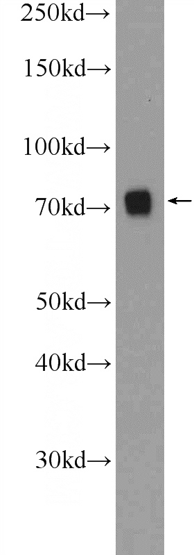 HepG2 cells were subjected to SDS PAGE followed by western blot with Catalog No:115108(SENP1 Antibody) at dilution of 1:1000