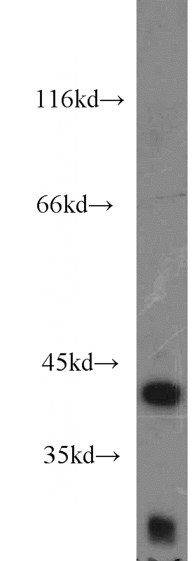 HEK-293 cells were subjected to SDS PAGE followed by western blot with Catalog No:111554(HSDL1 antibody) at dilution of 1:1000