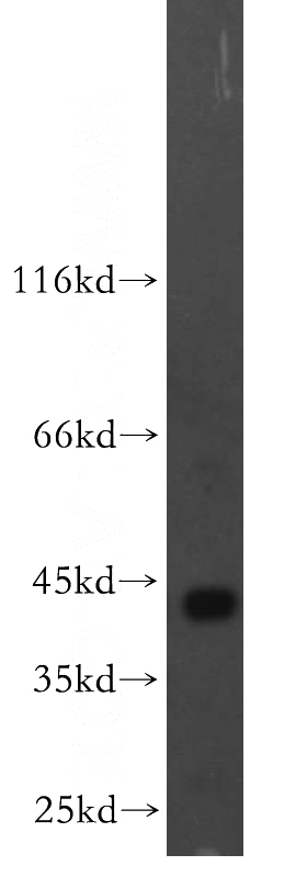 human brain tissue were subjected to SDS PAGE followed by western blot with Catalog No:107721(ACADS antibody) at dilution of 1:500