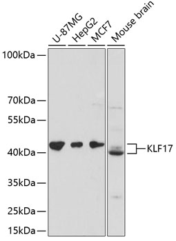 Western blot - KLF17 Polyclonal Antibody 