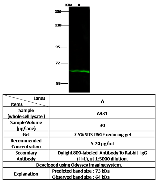 IL12RB1 / CD212 Antibody, Rabbit PAb, Antigen Affinity Purified, Western blot