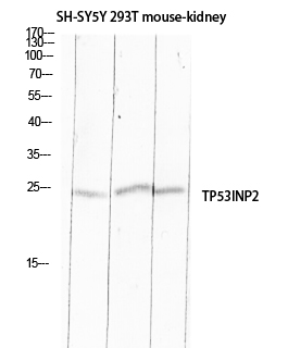 Fig1:; Western blot analysis of SH-SY5Y 293T mouse-kidney lysis using TP53INP2 antibody. Antibody was diluted at 1:500. Secondary antibody（catalog#：HA1001) was diluted at 1:20000 cells nucleus extracted by Minute TM Cytoplasmic and Nuclear Fractionation kit (SC-003,Inventbiotech,MN,USA).