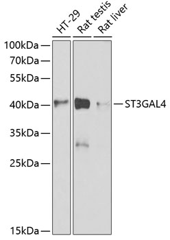 Western blot - ST3GAL4 Polyclonal Antibody 