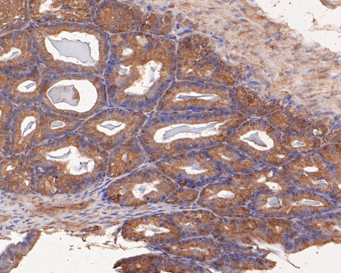 Fig5: Immunohistochemical analysis of paraffin-embedded rat seminal vesicle tissue using anti-SPATA5L1 antibody. The section was pre-treated using heat mediated antigen retrieval with Tris-EDTA buffer (pH 8.0-8.4) for 20 minutes.The tissues were blocked in 5% BSA for 30 minutes at room temperature, washed with ddH2O and PBS, and then probed with the primary antibody ( 1/50) for 30 minutes at room temperature. The detection was performed using an HRP conjugated compact polymer system. DAB was used as the chromogen. Tissues were counterstained with hematoxylin and mounted with DPX.
