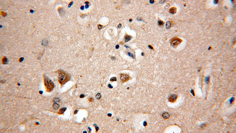 Immunohistochemical of paraffin-embedded human brain using Catalog No:112003(KIF19 antibody) at dilution of 1:50 (under 40x lens)