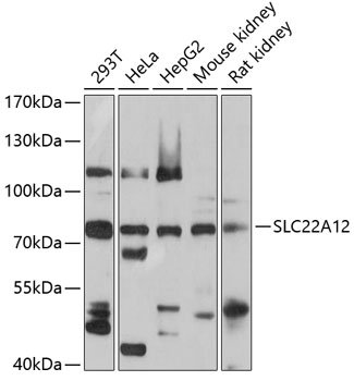 Western blot - SLC22A12 Polyclonal Antibody 