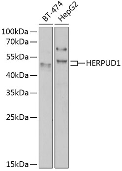 Western blot - HERPUD1 Polyclonal Antibody 