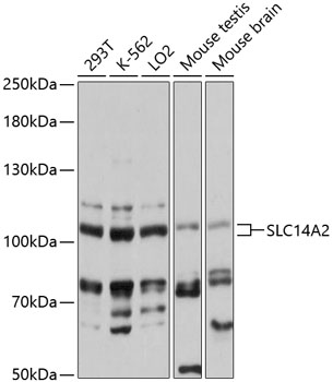 Western blot - SLC14A2 Polyclonal Antibody 