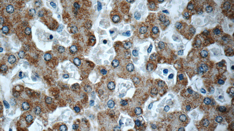 Immunohistochemistry of paraffin-embedded human liver slide using Catalog No:116385(TTC39B Antibody) at dilution of 1:50 (under 40x lens)