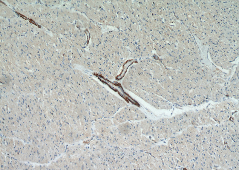 Immunohistochemical of paraffin-embedded human heart using Catalog No:115397(ACTA2-Specific antibody) at dilution of 1:100 (under 10x lens)