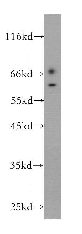 A431 cells were subjected to SDS PAGE followed by western blot with Catalog No:107479(PPARG antibody) at dilution of 1:300