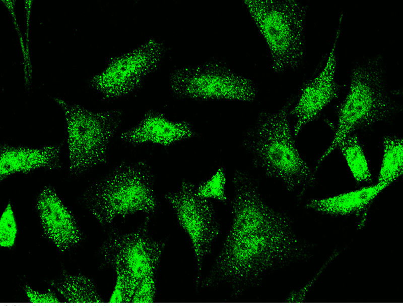 Human Jade1/PHF17 Immunofluorescence(IF) 14896
