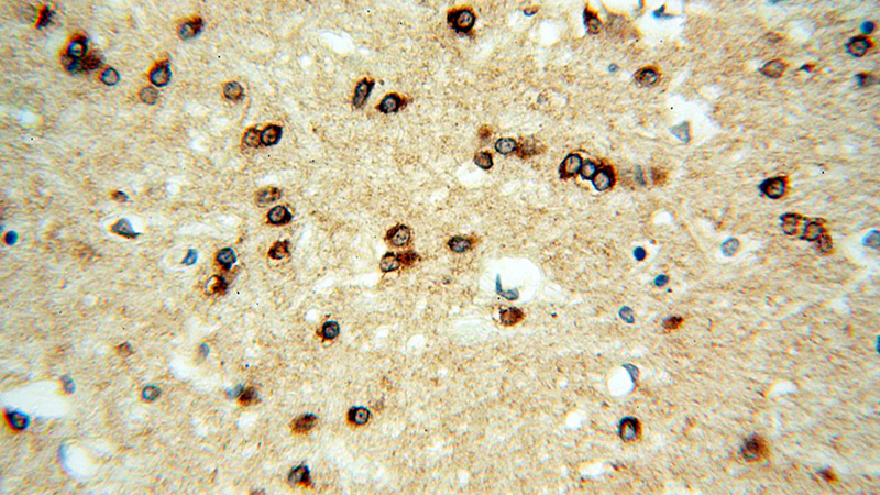 Immunohistochemical of paraffin-embedded human brain using Catalog No:114418(RAB2A antibody) at dilution of 1:100 (under 40x lens)