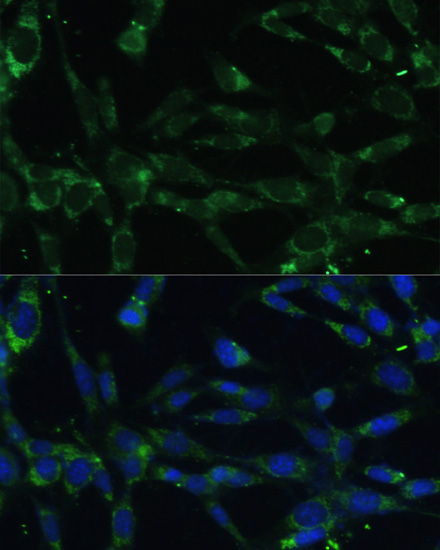 Immunofluorescence - CAPN5 Polyclonal Antibody 