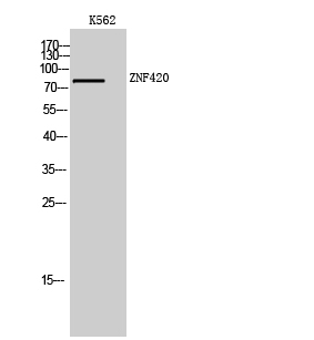 Fig1:; Western Blot analysis of K562 cells using ZNF420 Polyclonal Antibody. Secondary antibody（catalog#: HA1001) was diluted at 1:20000 cells nucleus extracted by Minute TM Cytoplasmic and Nuclear Fractionation kit (SC-003,Inventbiotech,MN,USA).