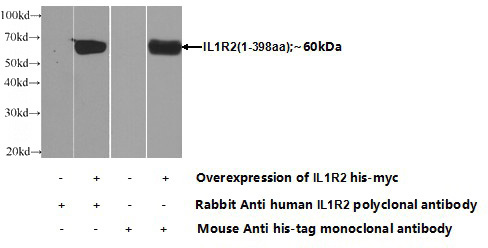 Transfected HEK-293 cells were subjected to SDS PAGE followed by western blot with Catalog No:111771(IL1R2 Antibody) at dilution of 1:1000