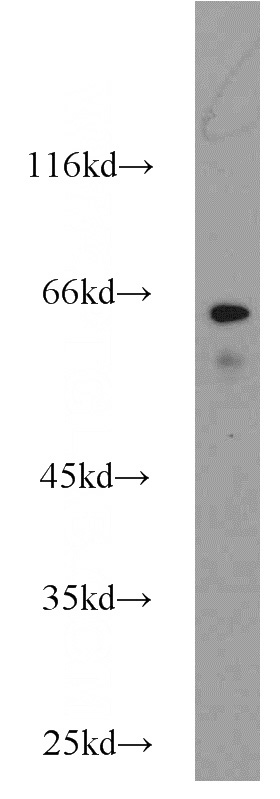 CHO cells were subjected to SDS PAGE followed by western blot with Catalog No:115842(MAP3K7 antibody) at dilution of 1:1000