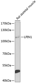 Western blot - LPIN1 Polyclonal Antibody 