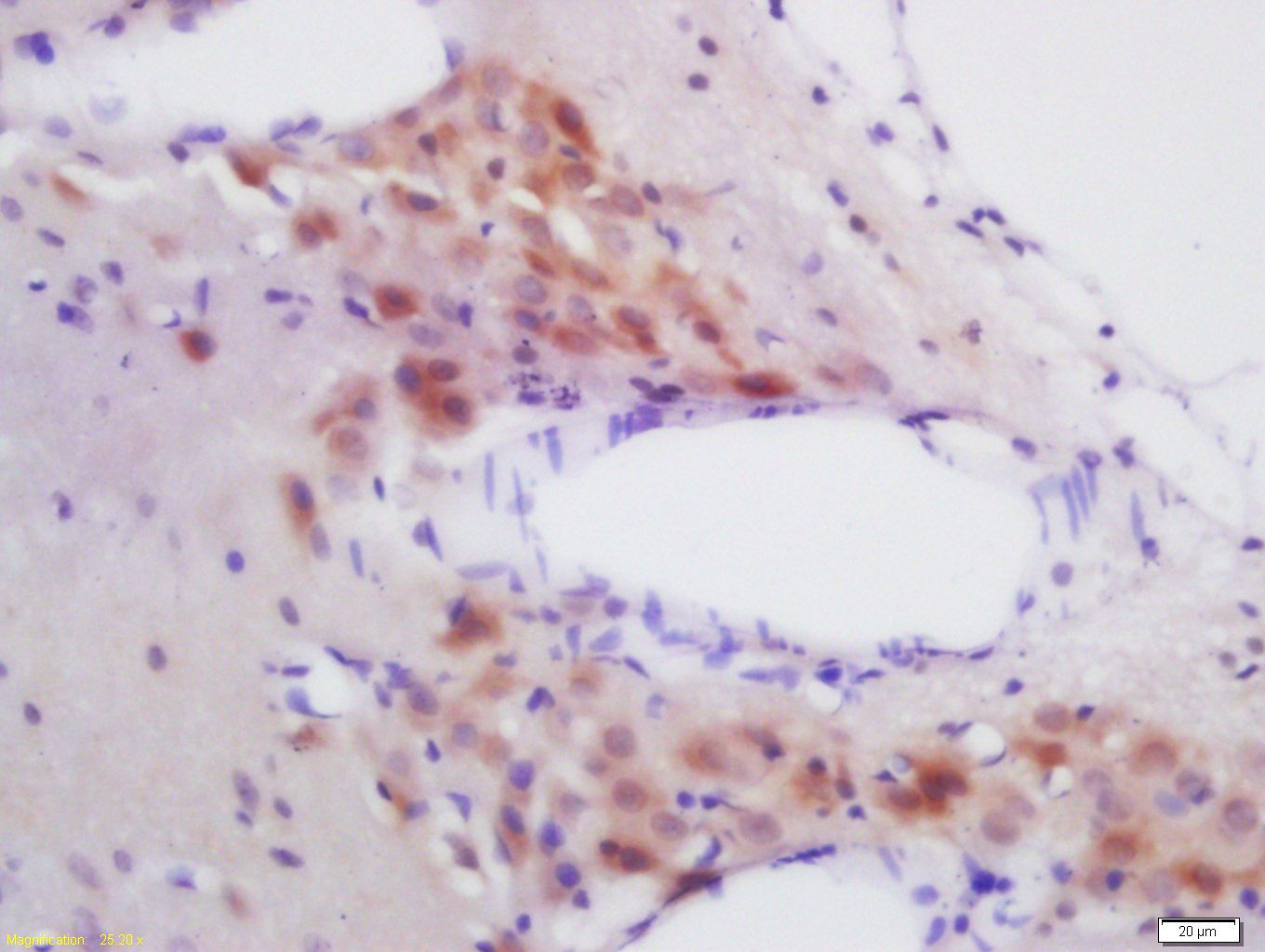 Fig3: Tissue/cell: rat brain tissue; 4% Paraformaldehyde-fixed and paraffin-embedded;; Antigen retrieval: citrate buffer ( 0.01M, pH 6.0 ), Boiling bathing for 15min; Block endogenous peroxidase by 3% Hydrogen peroxide for 30min; Blocking buffer (normal goat serum,C-0005) at 37℃ for 20 min;; Incubation: Anti-GLP-1R Polyclonal Antibody, Unconjugated 1:200, overnight at 4℃, followed by conjugation to the secondary antibody(SP-0023) and DAB(C-0010) staining