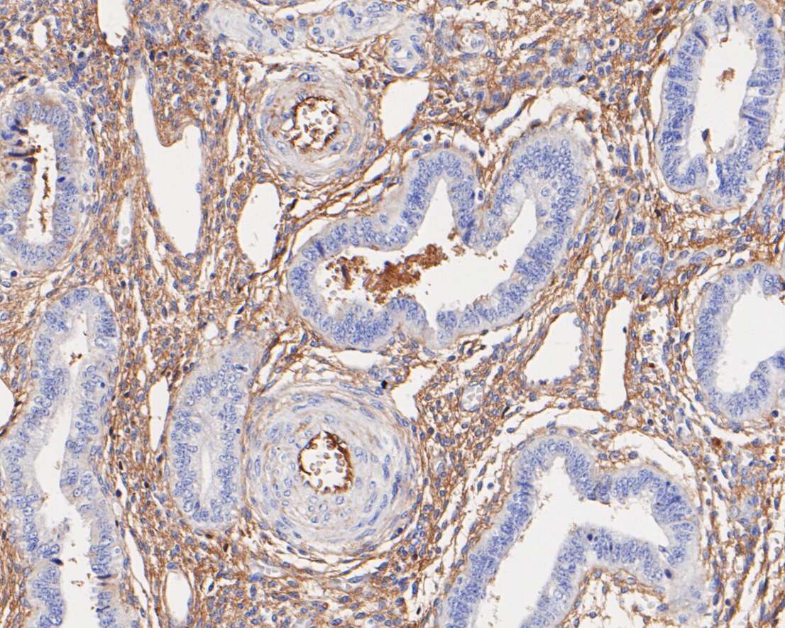 Fig6:; Immunohistochemical analysis of paraffin-embedded human uterus tissue using anti-Alpha-2-macroglobulin antibody. The section was pre-treated using heat mediated antigen retrieval with Tris-EDTA buffer (pH 8.0-8.4) for 20 minutes.The tissues were blocked in 5% BSA for 30 minutes at room temperature, washed with ddH; 2; O and PBS, and then probed with the primary antibody ( 1/500) for 30 minutes at room temperature. The detection was performed using an HRP conjugated compact polymer system. DAB was used as the chromogen. Tissues were counterstained with hematoxylin and mounted with DPX.