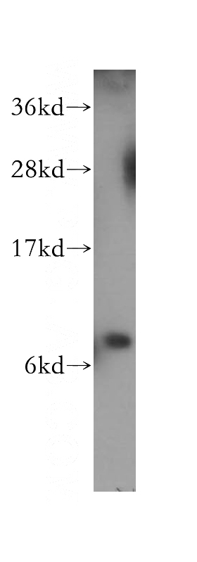 HeLa cells were subjected to SDS PAGE followed by western blot with Catalog No:114967(S100P antibody) at dilution of 1:1000