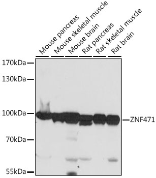 Western blot - ZNF471 Polyclonal Antibody 