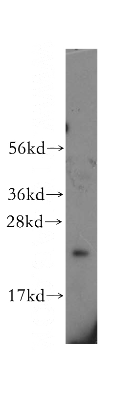 human ileum tissue were subjected to SDS PAGE followed by western blot with Catalog No:110250(EDN1 antibody) at dilution of 1:400
