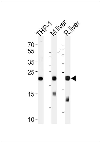 Western blot analysis of lysates from THP-1 cell line uff0cmouse liver and rat liver tissue (from left to right),using GPX1 Antibody (C-term)(Cat. #169114).169114 was diluted at 1:1000 at each lane. A goat anti-rabbit IgG H&L(HRP) at 1:5000 dilution was used as the secondary antibody.Lysates at 35ug per lane.