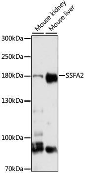 Western blot - SSFA2 Polyclonal Antibody 