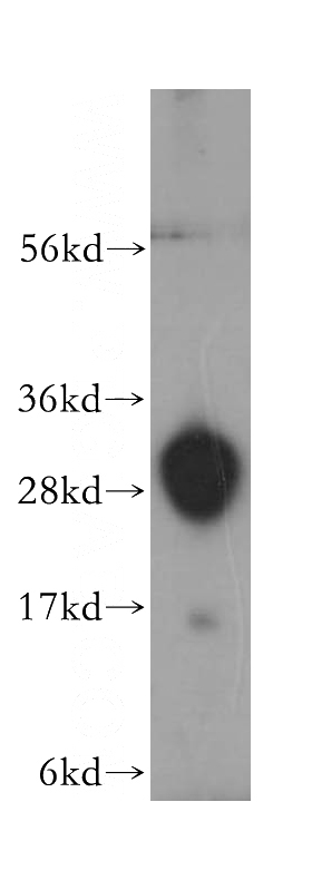 PC-3 cells were subjected to SDS PAGE followed by western blot with Catalog No:116356(TREM1 antibody) at dilution of 1:400