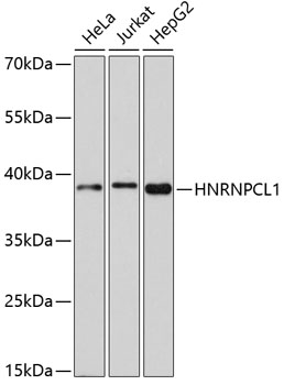 Western blot - HNRNPCL1 Polyclonal Antibody 