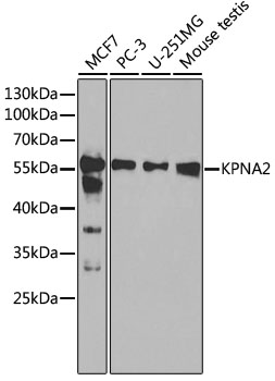Western blot - KPNA2 Polyclonal Antibody 