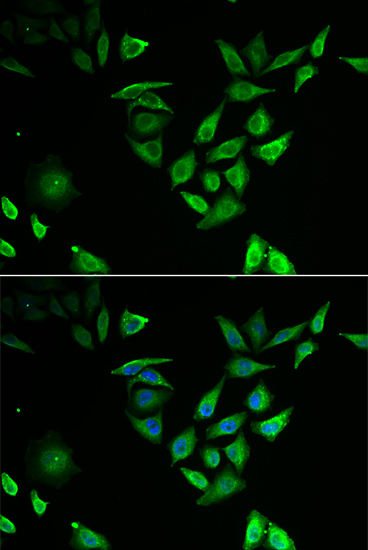 Immunofluorescence - NUTF2 Polyclonal Antibody 