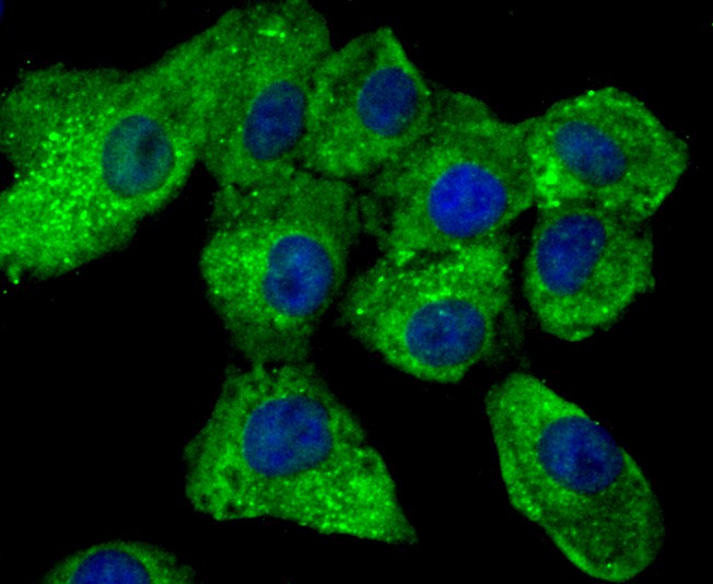 Fig2: ICC staining TGM6 in A549 cells (green). The nuclear counter stain is DAPI (blue). Cells were fixed in paraformaldehyde, permeabilised with 0.25% Triton X100/PBS.